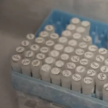 Ubwongereza bwatangiye amagerageza y'urukingo rwa Ebola rwakozwe mu byumweru umunani