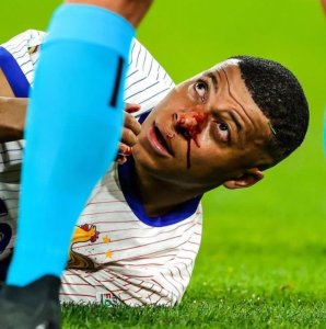 Hamenyekanye icyemezo cyafatiwe Mbappe wavunitse izuru