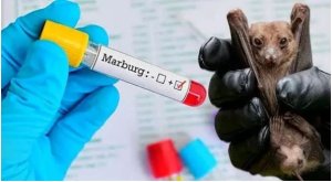 Minisante yatangaje inkomoko ya Marburg isaba Abanyarwanda kutihimura