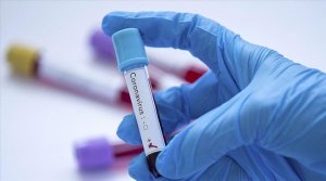 Habonetse abarwayi 38 ba Coronavirus bashya mu Rwanda hakira 27