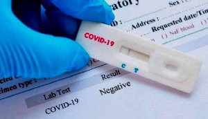 Abantu 42 banduye Coronavirus mu Rwanda abandi 12 barayikira