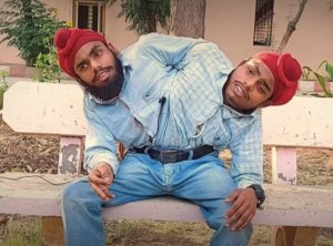Impanga zavutse zifatanye zahawe akazi aho zizajya zihembwa nk'abantu 2 batandukanye