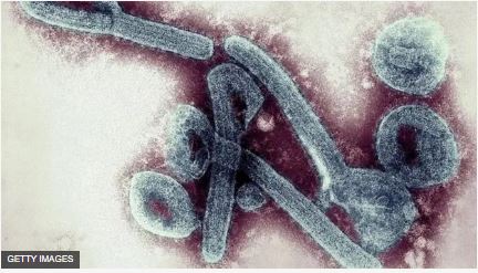 MINISANTE yemeje ko Virusi ya Marburg ijya gusa na Ebola yageze mu Rwanda 