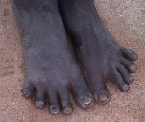Rubavu: Gitifu urwaje amavunja yiswe amashitani yasabwe gutanga ibisobanuro 