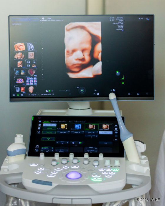 CHUK yahawe ‘Ultrasound' igezweho isuzuma ibibazo byose umwana uri mu nda afite