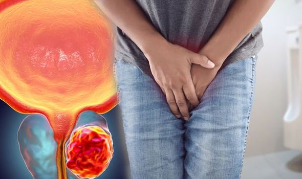 Dusobanukirwe n'uburwayi bwa porositate (prostate) indwara yibasira kandi igahitana abagabo batari bake