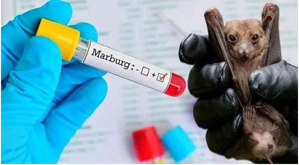 Minisante yatangaje inkomoko ya Marburg isaba Abanyarwanda kutihimura