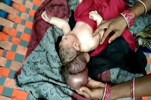 Umwana yavukanye imitwe itatu bahita batangira kumusenga nk'Imana