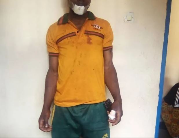 Gakenke: RIB yataye muri yombi umugore warumye umunwa w'umugabo we akenda kuwuca