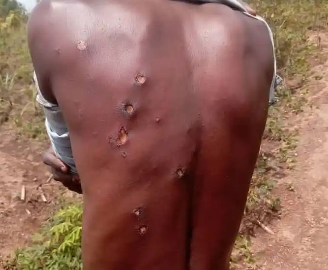 Nyanza:Inkuba yakubise umuturage imusigira ibikomere