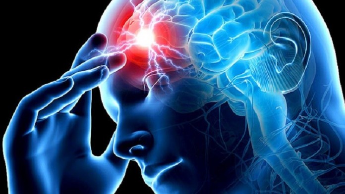 Byinshi wamenya ku ndwara ya Stroke ihitana benshi n'uburyo wayirinda