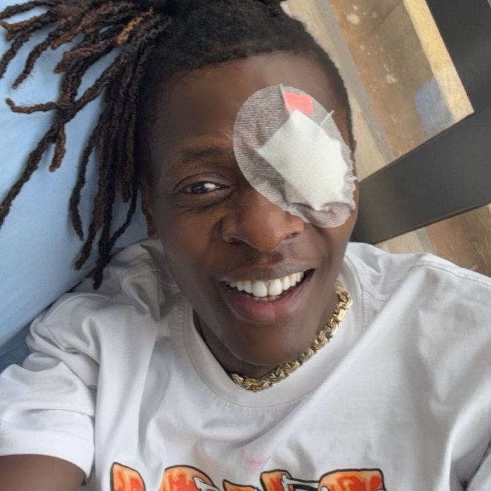 Jose Chameleone yabazwe ijisho nyuma yo gutangira guhuma