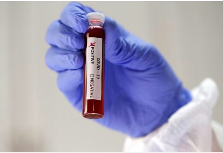 Habonetse abantu 17 banduye Coronavirus mu Rwanda hakira abandi 39