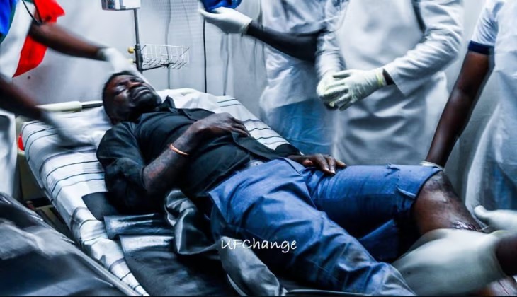 Uganda: Umujyanama avuga ko Bobi Wine yakomerekejwe n'umupolisi