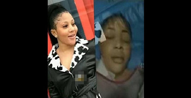 Umugore yaguye ku iseta amaze kwibagisha ashaka ubwiza bukurura abagabo