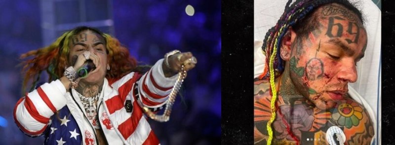  Umuraperi Tekashi 6ix9ine arembeye mu bitaro nyuma yo gukubitwa akagirwa intere