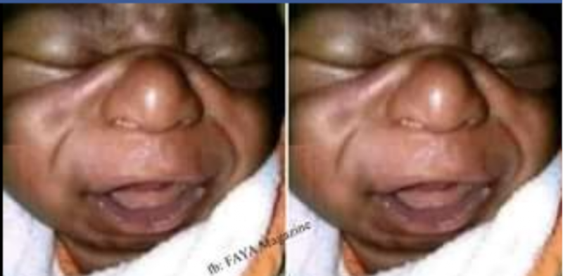 Umugore wabyaye umwana udafite uburanga yajyanywe mu nkiko n'umugabo we,amusaba akayabo k'impozamarira