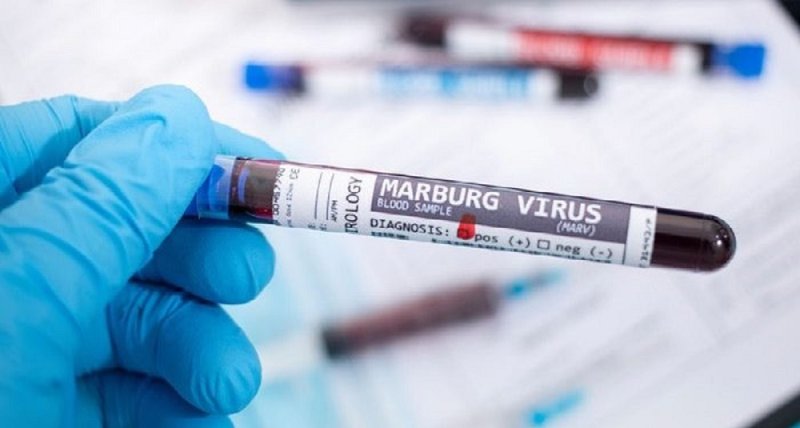 Tanzania yashyize yemera ko yagaragayemo icyorezo cya Marburg