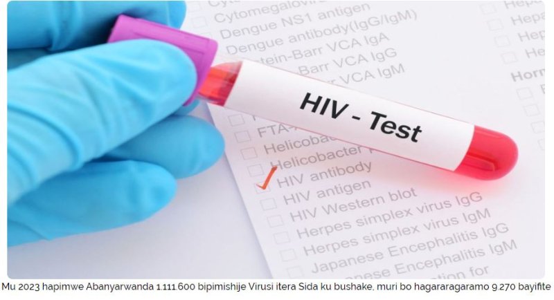 Mu mwaka umwe gusa Abaturarwanda barenga 9000 basanzwemo Virusi itera SIDA 