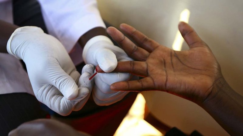 Dore uko wamenya ko wanduye agakoko gatera Sida