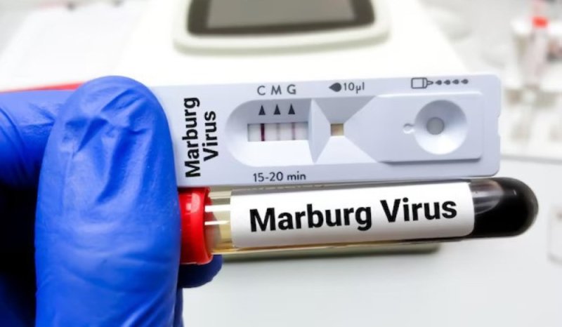 Abandi bantu mu Rwanda bakize Marburg