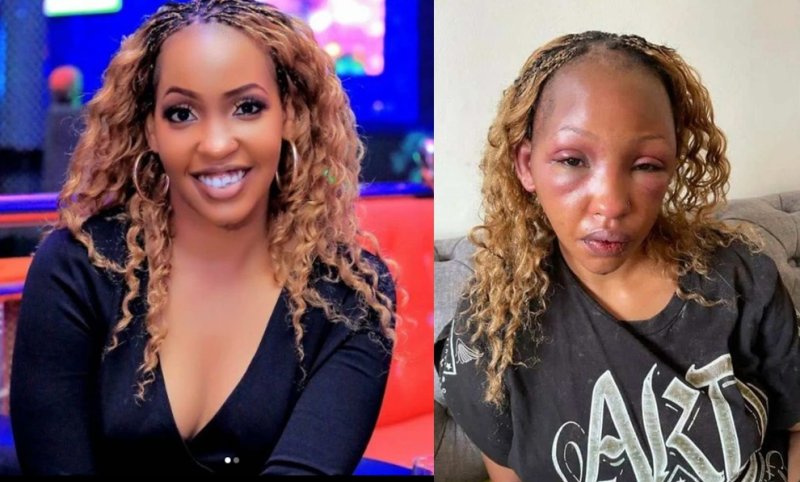 Nyuma y'iminsi Sandra Teta akorerwa ubuvugizi yatashye mu Rwanda