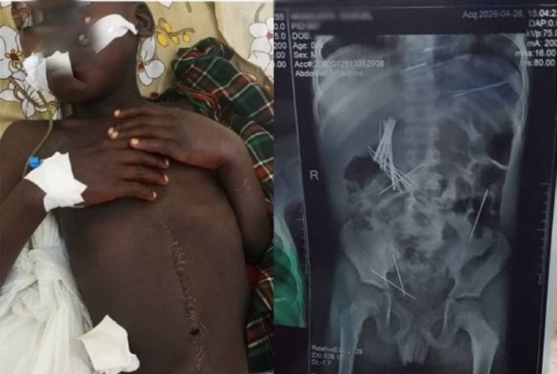 Uganda: Umugore afunzwe azira kugaburira umwana inshinge 46