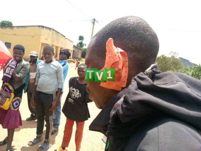 Ruhango: Umugabo yaciye ugutwi mugenzi we wari umufashe ari kumusambanyiriza umugore