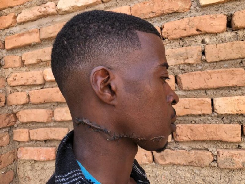 Abasore babiri barashinjwa gukebesha mugenzi wabo urwembe
