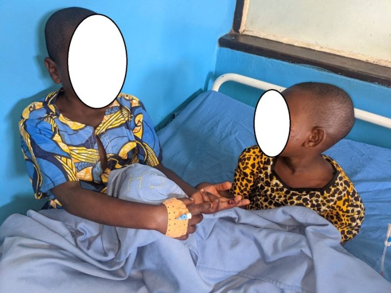 Rusizi: Abana 2 bariwe n'imbwebwe yo muri Pariki ya Nyungwe